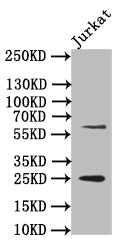 Western Blot
Positive WB detected in: JK whole cell lysate
All lanes: EBI3 antibody at 1:500
Secondary
Goat polyclonal to rabbit IgG at 1/50000 dilution
Predicted band size: 25 kDa
Observed band size: 25 kDa