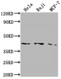 Western Blot
Positive WB detected in: Hela whole cell lysate, Raji whole cell lysate, MCF-7 whole cell lysate
All lanes: AGTR1 antibody at 1:2000
Secondary
Goat polyclonal to rabbit IgG at 1/50000 dilution
Predicted band size: 42 kDa
Observed band size: 42 kDa