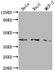 Western Blot
Positive WB detected in: Hela whole cell lysate, Raji whole cell lysate, MCF-7 whole cell lysate
All lanes: AGTR1 antibody at 1:2000
Secondary
Goat polyclonal to rabbit IgG at 1/50000 dilution
Predicted band size: 42 kDa
Observed band size: 42 kDa