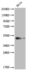 Western Blot
Positive WB detected in: Hela whole cell lysate
All lanes: BMP4 antibody at 1:2000
Secondary
Goat polyclonal to rabbit IgG at 1/50000 dilution
Predicted band size: 47 kDa
Observed band size: 36-55 kDa