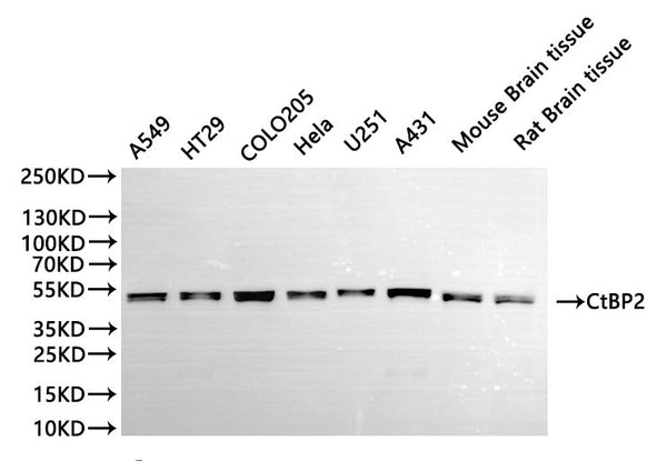 Western Blot, 
Positive WB detected in:A549 whole cell lysate(30µg), HT29 whole cell lysate(30µg), COLO205 whole cell lysate(30µg), HELA whole cell lysate(30µg), U251 whole cell lysate(30µg), A431 whole cell lysate(30µg), Mouse brain tissue lysate(30µg), Rat brain lysate(30µg)
All lanes: CtBP2 antibody at 1:1000
Secondary
Goat polyclonal to rabbit IgG at 1/40000 dilution
Predicted band size: 49 kDa
Observed band size: 49 kDa
Exposure time：10s