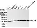 Western Blot
Positive WB detected in: Hela whole cell lysate(30µg) , COLO-205 whole cell lysate(30µg) , HT-29 whole cell lysate(30µg) , MCF-7 whole cell lysate(30µg) , Jurkat whole cell lysate(30µg) , U-937 whole cell lysate(30µg) , Mouse liver tissue lysate(30µg) 
All lanes: RPL10A antibody at 1:1000
Secondary
Goat polyclonal to rabbit IgG at 1/40000 dilution
Predicted band size: 25 kDa
Observed band size: 26 kDa
Exposure time：1min