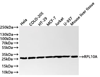 Western Blot
Positive WB detected in: Hela whole cell lysate(30µg) , COLO-205 whole cell lysate(30µg) , HT-29 whole cell lysate(30µg) , MCF-7 whole cell lysate(30µg) , Jurkat whole cell lysate(30µg) , U-937 whole cell lysate(30µg) , Mouse liver tissue lysate(30µg) 
All lanes: RPL10A antibody at 1:1000
Secondary
Goat polyclonal to rabbit IgG at 1/40000 dilution
Predicted band size: 25 kDa
Observed band size: 26 kDa
Exposure time：1min
