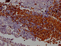 PARP1 Antibody – Figure 1 of 1