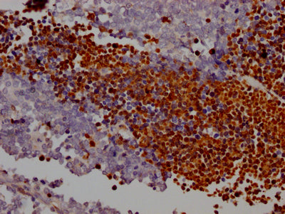 PARP1 Antibody – Figure 1 of 1