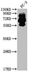 Western Blot
Positive WB detected in: PC-3 whole cell lysate
All lanes: PCSK9 antibody at 1:2000
Secondary
Goat polyclonal to rabbit IgG at 1/50000 dilution
Predicted band size: 75, 21 kDa
Observed band size: 60, 75 kDa