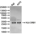 Western Blot, 
Positive WB detected in:Raji whole cell lysate(30µg), A375 whole cell lysate(30µg)
All lanes: HLA DRB1 antibody at 1:1000
Secondary
Goat polyclonal to rabbit IgG at 1/40000 dilution
Predicted band size: 30 kDa
Observed band size: 30 kDa
Exposure time：180s