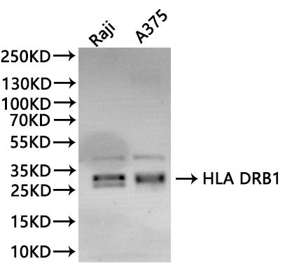 Western Blot, 
Positive WB detected in:Raji whole cell lysate(30µg), A375 whole cell lysate(30µg)
All lanes: HLA DRB1 antibody at 1:1000
Secondary
Goat polyclonal to rabbit IgG at 1/40000 dilution
Predicted band size: 30 kDa
Observed band size: 30 kDa
Exposure time：180s