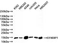 Western Blot
Positive WB detected in: K562 whole cell lysate(30µg) , HEK293 whole cell lysate(30µg) , A549 whole cell lysate(30µg) , COLO205 whole cell lysate(30µg) , HeLa whole cell lysate(30µg) , HEK293T whole cell lysate(30µg) 
All lanes: EIF4EBP1 antibody at 1:1000
Secondary
Goat polyclonal to rabbit IgG at 1/50000 dilution
Predicted band size: 13 kDa
Observed band size: 13 kDa
Exposure time: 3min