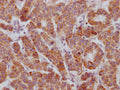 ACVR2B Antibody – Figure 1 of 2