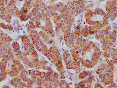 ACVR2B Antibody – Figure 1 of 2