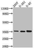 Western Blot
Positive WB detected in: 293T whole cell lysate, U-251 whole cell lysate, U-87 whole cell lysate
All lanes: Osteopontin Antibody at 1:1000
Secondary
Goat polyclonal to rabbit IgG at 1/50000 dilution
Predicted band size: 36, 34, 33, 34, 34 kDa
Observed band size: 36 kDa