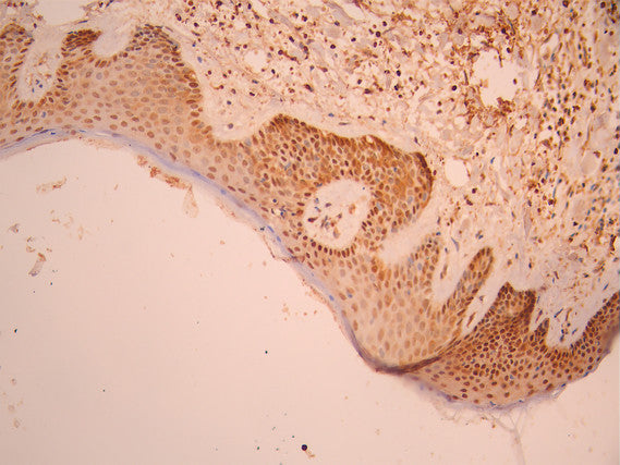 IHC image of CSB-RA261359A0HU diluted at 1:100 and staining in paraffin-embedded human skin tissue performed on a Leica BondTM system. After dewaxing and hydration, antigen retrieval was mediated by high pressure in a citrate buffer (pH 6.0). Section was blocked with 10% normal goat serum 30min at RT. Then primary antibody (1% BSA) was incubated at 4°C overnight. The primary is detected by a Goat anti-rabbit polymer IgG labeled by HRP and visualized using 0.05% DAB.