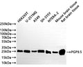Western Blot
Positive WB detected in: HEK293T whole cell lysate(20µg) , U-251MG whole cell lysate(20µg) ,A549 whole cell lysate(20µg) ,SH-SY5Y whole cell lysate(20µg) ,NTERA-2 whole cell lysate(20µg) , Mouse brain tissue lysate(20µg) , Rat brain tissue lysate(20µg) 
All lanes: PGP9.5 antibody at 1:1000
Secondary
Goat polyclonal to rabbit IgG at 1/40000 dilution
Predicted band size: 25 kDa
Observed band size: 26 kDa
Exposure time：50s