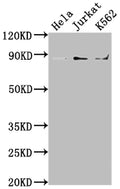 Western Blot
Positive WB detected in: Hela whole cell lysate, Jurkat whole cell lysate, K562 whole cell lysate
All lanes: IKBKB antibody at 1:2000
Secondary
Goat polyclonal to rabbit IgG at 1/50000 dilution
Predicted band size: 87, 86, 30, 80 kDa
Observed band size: 87 kDa