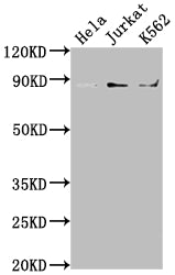 Western Blot
Positive WB detected in: Hela whole cell lysate, Jurkat whole cell lysate, K562 whole cell lysate
All lanes: IKBKB antibody at 1:2000
Secondary
Goat polyclonal to rabbit IgG at 1/50000 dilution
Predicted band size: 87, 86, 30, 80 kDa
Observed band size: 87 kDa