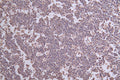 IHC image of CSB-RA262013A0HU diluted at 1:50 and staining in paraffin-embedded human tonsil tissue performed on a Leica BondTM system. After dewaxing and hydration, antigen retrieval was mediated by high pressure in a citrate buffer (pH 6.0) . Section was blocked with 10% normal goat serum 30min at RT. Then primary antibody (1% BSA) was incubated at 4°C overnight. The primary is detected by a Goat anti-rabbit polymer IgG labeled by HRP and visualized using 0.30% DAB.