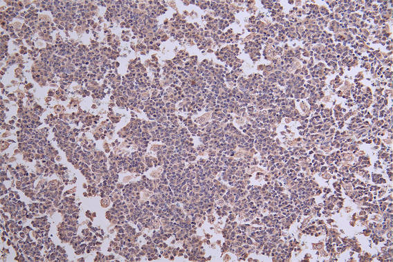 IHC image of CSB-RA262013A0HU diluted at 1:50 and staining in paraffin-embedded human tonsil tissue performed on a Leica BondTM system. After dewaxing and hydration, antigen retrieval was mediated by high pressure in a citrate buffer (pH 6.0) . Section was blocked with 10% normal goat serum 30min at RT. Then primary antibody (1% BSA) was incubated at 4°C overnight. The primary is detected by a Goat anti-rabbit polymer IgG labeled by HRP and visualized using 0.30% DAB.