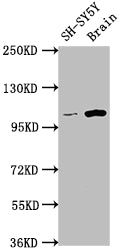 Western Blot
Positive WB detected in: SH-SY5Y whole cell lysate, Rat brain tissue
All lanes: LGR5 antibody at 1:1500
Secondary
Goat polyclonal to rabbit IgG at 1/50000 dilution
Predicted band size: 100, 98, 93 kDa
Observed band size: 100 kDa
