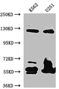 Western Blot
Positive WB detected in: K562 whole cell lysate, U-251 whole cell lysate
All lanes: BubR1 antibody at 1:1000
Secondary
Goat polyclonal to rabbit IgG at 1/50000 dilution
Predicted band size: 120, 106, 122 kDa
Observed band size: 125 kDa