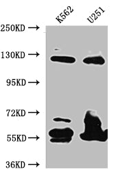 Western Blot
Positive WB detected in: K562 whole cell lysate, U-251 whole cell lysate
All lanes: BubR1 antibody at 1:1000
Secondary
Goat polyclonal to rabbit IgG at 1/50000 dilution
Predicted band size: 120, 106, 122 kDa
Observed band size: 125 kDa