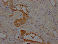 IHC image of CSB-RA263831A0HU diluted at 1:100 and staining in paraffin-embedded human kidney tissue performed on a Leica BondTM system. After dewaxing and hydration, antigen retrieval was mediated by high pressure in a citrate buffer (pH 6.0) . Section was blocked with 10% normal goat serum 30min at RT. Then primary antibody (1% BSA) was incubated at 4℃ overnight. The primary is detected by a Goat anti-rabbit IgG polymer labeled by HRP and visualized using 0.05% DAB.