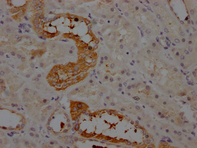 IHC image of CSB-RA263831A0HU diluted at 1:100 and staining in paraffin-embedded human kidney tissue performed on a Leica BondTM system. After dewaxing and hydration, antigen retrieval was mediated by high pressure in a citrate buffer (pH 6.0) . Section was blocked with 10% normal goat serum 30min at RT. Then primary antibody (1% BSA) was incubated at 4℃ overnight. The primary is detected by a Goat anti-rabbit IgG polymer labeled by HRP and visualized using 0.05% DAB.