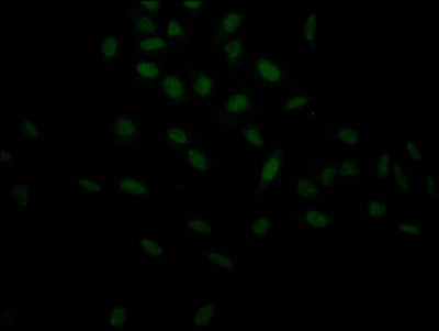 Immunofluorescence staining of Hela Cells with CSB-RA263943A0HU at 1:50, counter-stained with DAPI. The cells were fixed in 4% formaldehyde, permeated by 0.2% TritonX-100, and blocked in 10% normal Goat Serum. The cells were then incubated with the antibody overnight at 4℃. Nuclear DNA was labeled in blue with DAPI. The secondary antibody was FITC-conjugated AffiniPure Goat Anti-Rabbit IgG (H+L) .