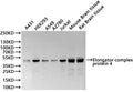 Western Blot
Positive WB detected in: A431 whole cell lysate(30µg), HEK293 whole cell lysate(30µg), A549 whole cell lysate(30µg), A2780 whole cell lysate(30µg), Jurkat whole cell lysate(30µg), Mouse brain tissue lysate(30µg), Rat brain tissue lysate(30µg)
All lanes:Elongator complex protein 4 antibody at 1:1000
Secondary
Goat polyclonal to rabbit IgG at 1/40000 dilution
Predicted band size: 47 kDa
Observed band size: 47 kDa
Exposure time：1min