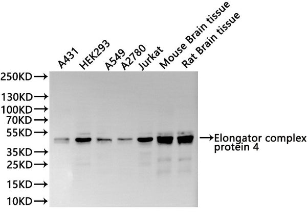 Western Blot
Positive WB detected in: A431 whole cell lysate(30µg), HEK293 whole cell lysate(30µg), A549 whole cell lysate(30µg), A2780 whole cell lysate(30µg), Jurkat whole cell lysate(30µg), Mouse brain tissue lysate(30µg), Rat brain tissue lysate(30µg)
All lanes:Elongator complex protein 4 antibody at 1:1000
Secondary
Goat polyclonal to rabbit IgG at 1/40000 dilution
Predicted band size: 47 kDa
Observed band size: 47 kDa
Exposure time：1min