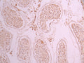 IHC image of CSB-RA264975A0HU diluted at 1:100 and staining in paraffin-embedded human testis tissue performed on a Leica BondTM system. After dewaxing and hydration, antigen retrieval was mediated by high pressure in a citrate buffer (pH 6.0) . Section was blocked with 10% normal goat serum 30min at RT. Then primary antibody (1% BSA) was incubated at 4°C overnight. The primary is detected by a Goat anti-rabbit polymer IgG labeled by HRP and visualized using 0.05% DAB.