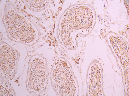 IHC image of CSB-RA264975A0HU diluted at 1:100 and staining in paraffin-embedded human testis tissue performed on a Leica BondTM system. After dewaxing and hydration, antigen retrieval was mediated by high pressure in a citrate buffer (pH 6.0) . Section was blocked with 10% normal goat serum 30min at RT. Then primary antibody (1% BSA) was incubated at 4°C overnight. The primary is detected by a Goat anti-rabbit polymer IgG labeled by HRP and visualized using 0.05% DAB.