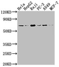 ALAS1 Antibody – Figure 1 of 1