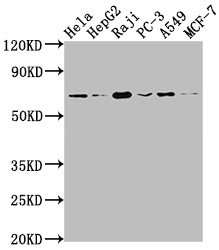 ALAS1 Antibody – Figure 1 of 1