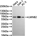 Western Blot
Positive WB detected in: HeLa whole cell lysate(30µg) , THP-1 whole cell lysate, PC-3 whole cell lysate(30µg) 
All lanes: LMNB2 antibody at 1:1000
Secondary
Goat polyclonal to rabbit IgG at 1/50000 dilution
Predicted band size: 70 kDa
Observed band size: 68 kDa
Exposure time: 3min