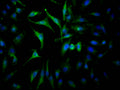 Immunofluorescence staining of Hela Cells with CSB-RA267127A0HU at 1:50, counter-stained with DAPI. The cells were fixed in 4% formaldehyde, permeated by 0.2% TritonX-100, and blocked in 10% normal Goat Serum. The cells were then incubated with the antibody overnight at 4℃. Nuclear DNA was labeled in blue with DAPI. The secondary antibody was FITC-conjugated AffiniPure Goat Anti-Rabbit IgG (H+L) .