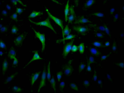 Immunofluorescence staining of Hela Cells with CSB-RA267127A0HU at 1:50, counter-stained with DAPI. The cells were fixed in 4% formaldehyde, permeated by 0.2% TritonX-100, and blocked in 10% normal Goat Serum. The cells were then incubated with the antibody overnight at 4℃. Nuclear DNA was labeled in blue with DAPI. The secondary antibody was FITC-conjugated AffiniPure Goat Anti-Rabbit IgG (H+L) .