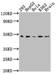 Western Blot
Positive WB detected in: 293 whole cell lysate, HepG2 whole cell lysate, Hela whole cell lysate, K562 whole cell lysate, Rat brain tissue
All lanes: FNTB antibody at 1:2000
Secondary
Goat polyclonal to rabbit IgG at 1/50000 dilution
Predicted band size: 49, 44 kDa
Observed band size: 49 kDa