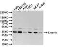 Western Blot
Positive WB detected in: Hela whole cell lysate(30µg), HEK293 whole cell lysate(30µg), A431 whole cell lysate(30µg), U-251MG whole cell lysate(30µg), MCF-7 whole cell lysate(30µg), Jurkat whole cell lysate(30µg)
All lanes: Emerin antibody at 1:1000
Secondary
Goat polyclonal to rabbit IgG at 1/40000 dilution
Predicted band size: 29 kDa
Observed band size: 35 kDa
Exposure time：30s