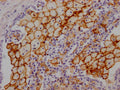 ACE Antibody – Figure 1 of 2