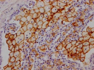 ACE Antibody – Figure 1 of 2