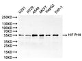 Western Blot
Positive WB detected in: U-251MG whole cell lysate(30µg), HT-29 whole cell lysate(30µg), A549 whole cell lysate(30µg), MCF-7 whole cell lysate(30µg), HepG2 whole cell lysate(30µg), THP-1 whole cell lysate(30µg)
All lanes:HIF PH4 antibody at 1:1000
Secondary
Goat polyclonal to rabbit IgG at 1/40000 dilution
Predicted band size: 57 kDa
Observed band size: 55 kDa
Exposure time：1min
