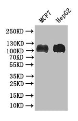 Western Blot
Positive WB detected in: MCF7 whole cell lysate, HEPG2 whole cell lysate
All lanes: BACH1/BRIP1 antibody at 1:1000
Secondary
Goat polyclonal to rabbit IgG at 1/50000 dilution
Predicted band size: 105 kDa
Observed band size: 105 kDa