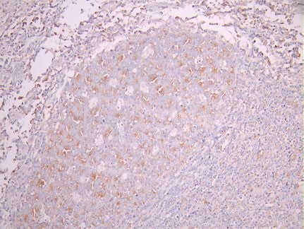 IHC image of CSB-RA270243A0HU diluted at 1:100 and staining in paraffin-embedded human tonsil tissue performed on a Leica BondTM system. After dewaxing and hydration, antigen retrieval was mediated by high pressure in a citrate buffer (pH 6.0). Section was blocked with 10% normal goat serum 30min at RT. Then primary antibody (1% BSA) was incubated at 4°C overnight. The primary is detected by a Goat anti-rabbit polymer IgG labeled by HRP and visualized using 0.05% DAB.