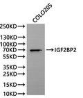 Western Blot, 
Positive WB detected in:COLO205 whole cell lysate(30µg)
All lanes: IGF2BP2 antibody at 1:1000
Secondary
Goat polyclonal to rabbit IgG at 1/40000 dilution
Predicted band size: 66 kDa
Observed band size: 70 kDa
Exposure time：300s