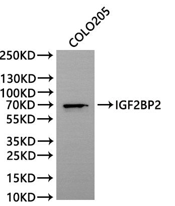 Western Blot, 
Positive WB detected in:COLO205 whole cell lysate(30µg)
All lanes: IGF2BP2 antibody at 1:1000
Secondary
Goat polyclonal to rabbit IgG at 1/40000 dilution
Predicted band size: 66 kDa
Observed band size: 70 kDa
Exposure time：300s