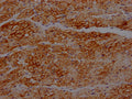 IHC image of CSB-RA271553A0HU diluted at 1:100 and staining in paraffin-embedded human heart tissue performed on a Leica BondTM system. After dewaxing and hydration, antigen retrieval was mediated by high pressure in a citrate buffer (pH 6.0) . Section was blocked with 10% normal goat serum 30min at RT. Then primary antibody (1% BSA) was incubated at 4℃ overnight. The primary is detected by a Goat anti-rabbit IgG polymer labeled by HRP and visualized using 0.05% DAB.