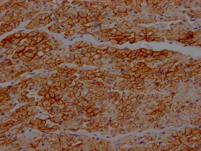 IHC image of CSB-RA271553A0HU diluted at 1:100 and staining in paraffin-embedded human heart tissue performed on a Leica BondTM system. After dewaxing and hydration, antigen retrieval was mediated by high pressure in a citrate buffer (pH 6.0) . Section was blocked with 10% normal goat serum 30min at RT. Then primary antibody (1% BSA) was incubated at 4℃ overnight. The primary is detected by a Goat anti-rabbit IgG polymer labeled by HRP and visualized using 0.05% DAB.