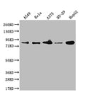Western Blot
Positive WB detected in: A549 whole cell lysate, Hela whole cell lysate, A375 whole cell lysate, HT-29 whole cell lysate, HepG2 whole cell lysate, U-87 whole cell lysate
All lanes: Furin antibody at 1:1000
Secondary
Goat polyclonal to rabbit IgG at 1/50000 dilution
Predicted band size: 87 kDa
Observed band size: 87, 72 kDa