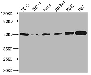 Western Blot
Positive WB detected in: PC-3 whole cell lysate, THP-1 whole cell lysate, Hela whole cell lysate, Jurkat whole cell lysate, K562 whole cell lysate, U87 whole cell lysate
All lanes: PTPN1 antibody at 1:2000
Secondary
Goat polyclonal to rabbit IgG at 1/50000 dilution
Predicted band size: 50 kDa
Observed band size: 50 kDa